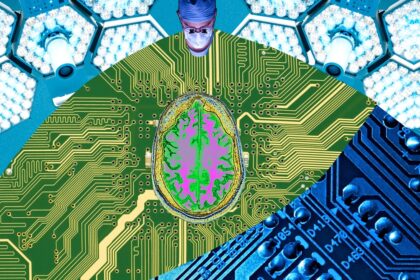 Your Next Job: Brain-Computer Interface Surgeon - WIRED