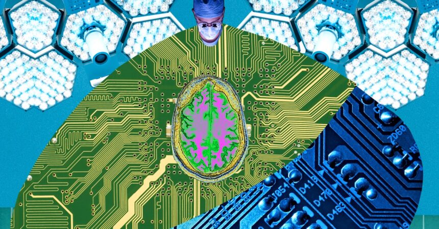 Your Next Job: Brain-Computer Interface Surgeon - WIRED